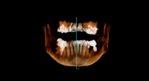 Diagnostische Radiologie