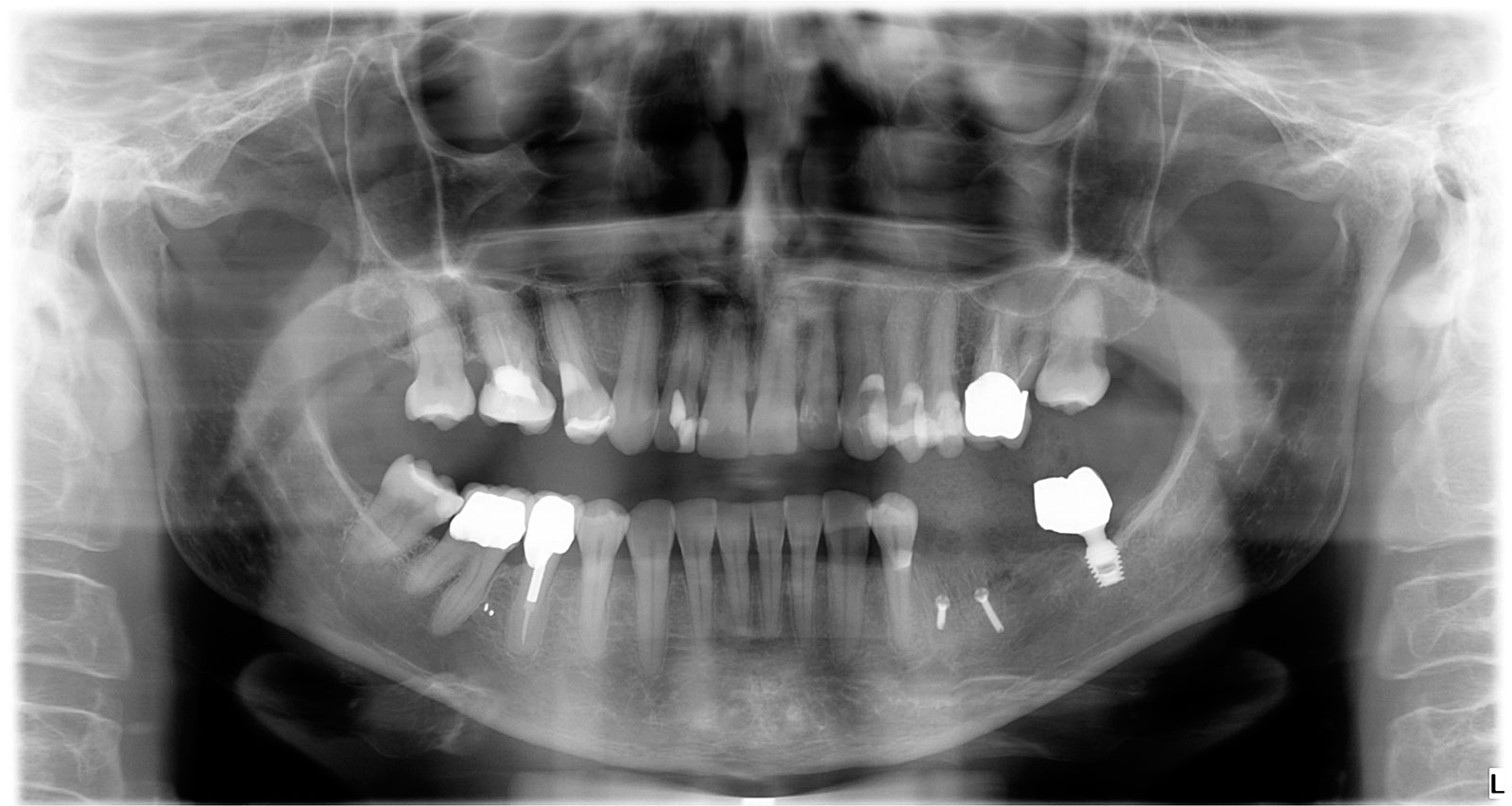 Diagnostische Radiologie